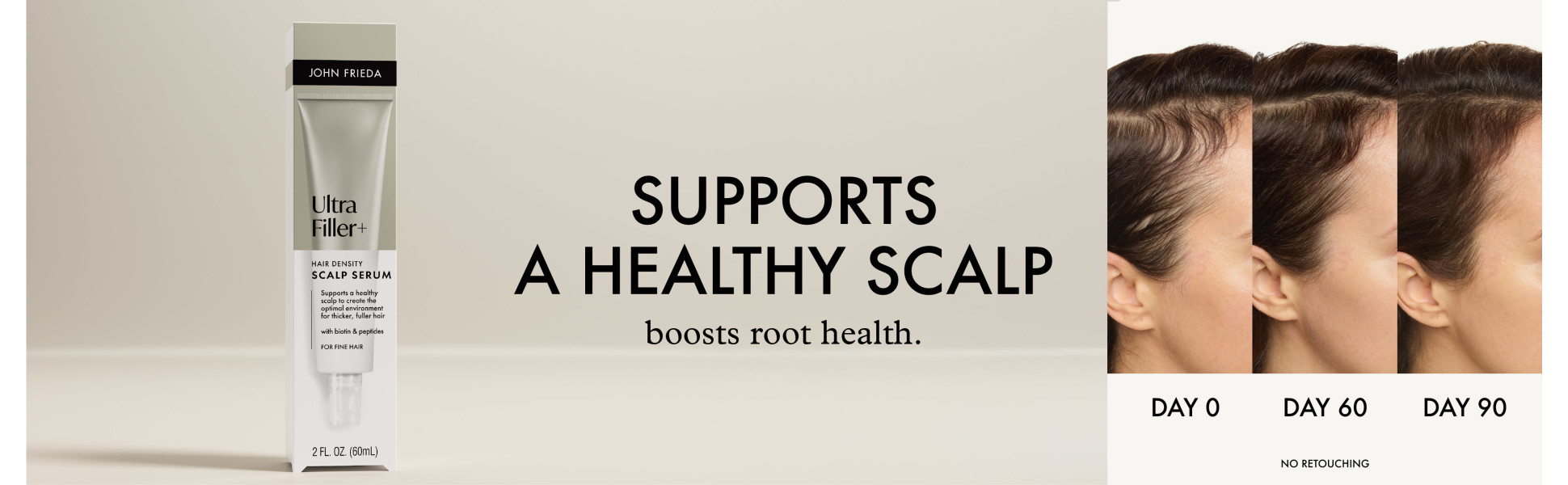 Before / After imagery for John Frieda UltraFiller+ Scalp Serum.