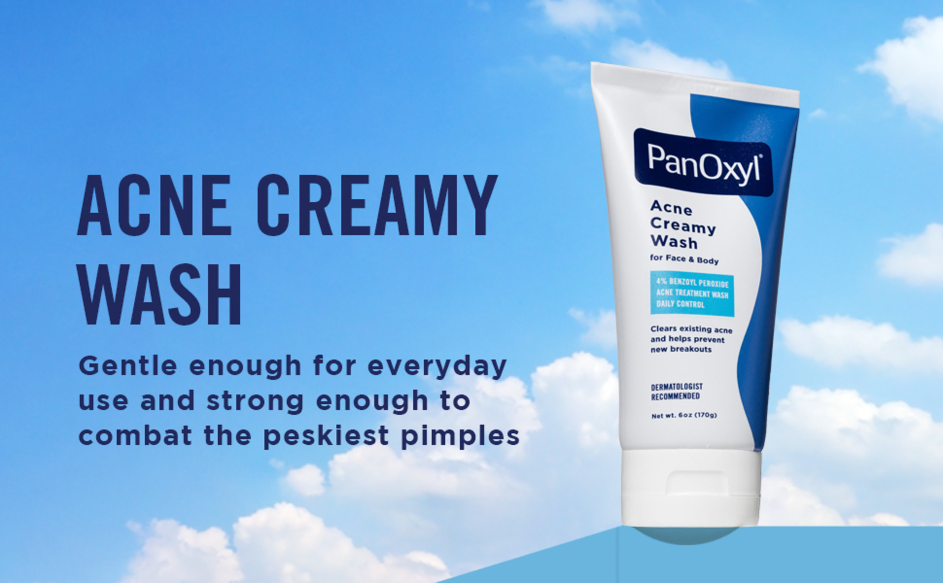 Acne Creamy Wash -- Gentle enough for everyday use and strong enough to combat the peskiest pimples